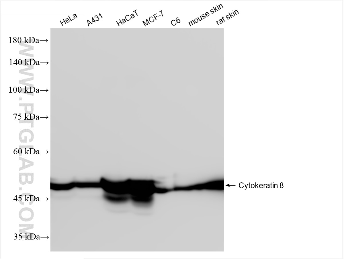 Various lysates were subjected to SDS PAGE followed by western blot with 86457-4-RR (Cytokeratin 8 antibody) at dilution of 1:10000 incubated at room temperature for 1.5 hours. This data was developed using the same antibody clone with 86457-4-PBS in a different storage buffer formulation. Western Blot (WB) analysis of various lysates using Cytokeratin 8 Recombinant monoclonal antibody (86457-4-RR)