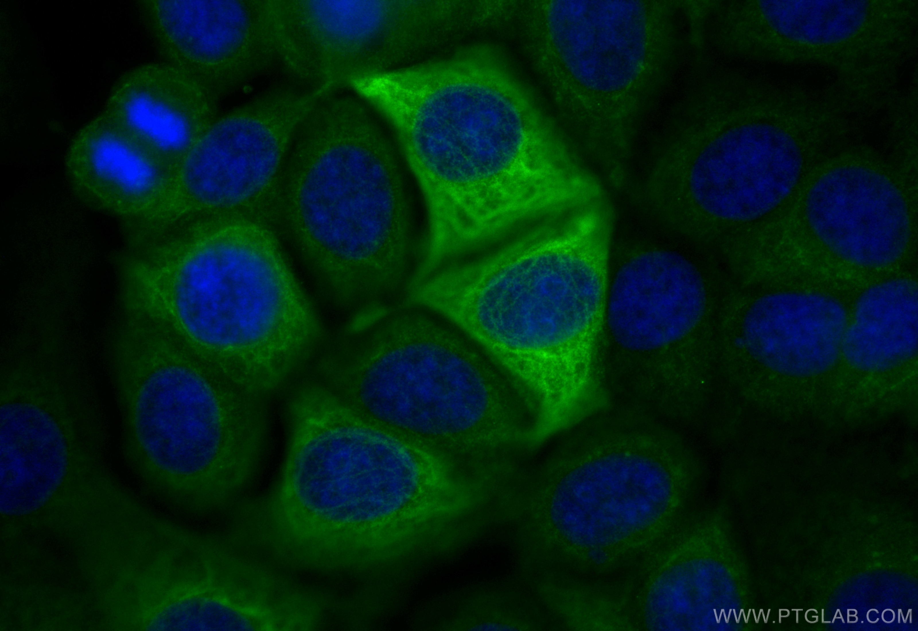 Immunofluorescence (IF) / fluorescent staining of MCF-7 cells using CoraLite® Plus 488-conjugated Cytokeratin 8 Polycl (CL488-10384)
