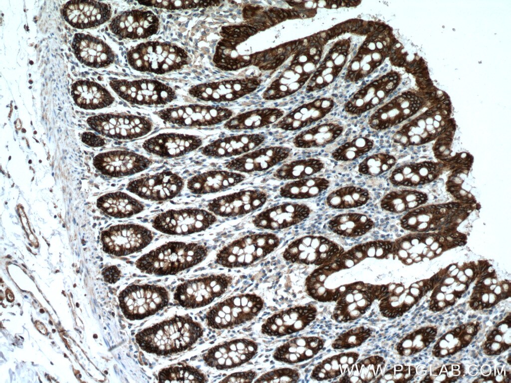 Immunohistochemistry (IHC) staining of human colon tissue using Cytokeratin 8-specific Polyclonal antibody (27105-1-AP)