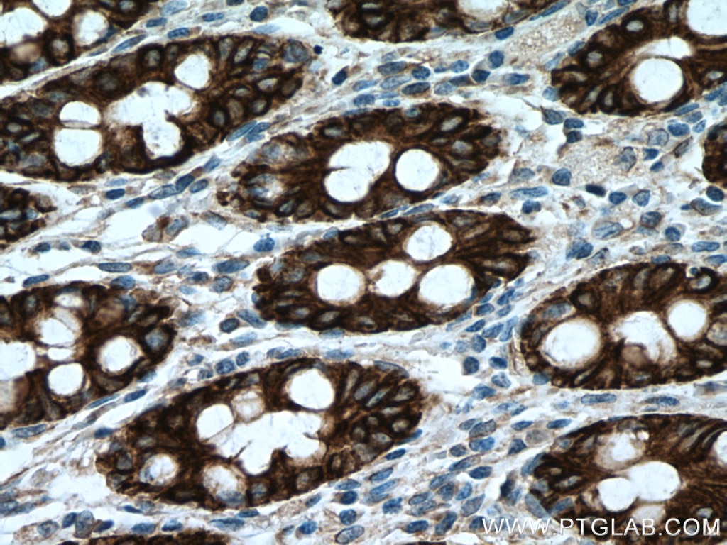 Immunohistochemistry (IHC) staining of human colon tissue using Cytokeratin 8-specific Polyclonal antibody (27105-1-AP)