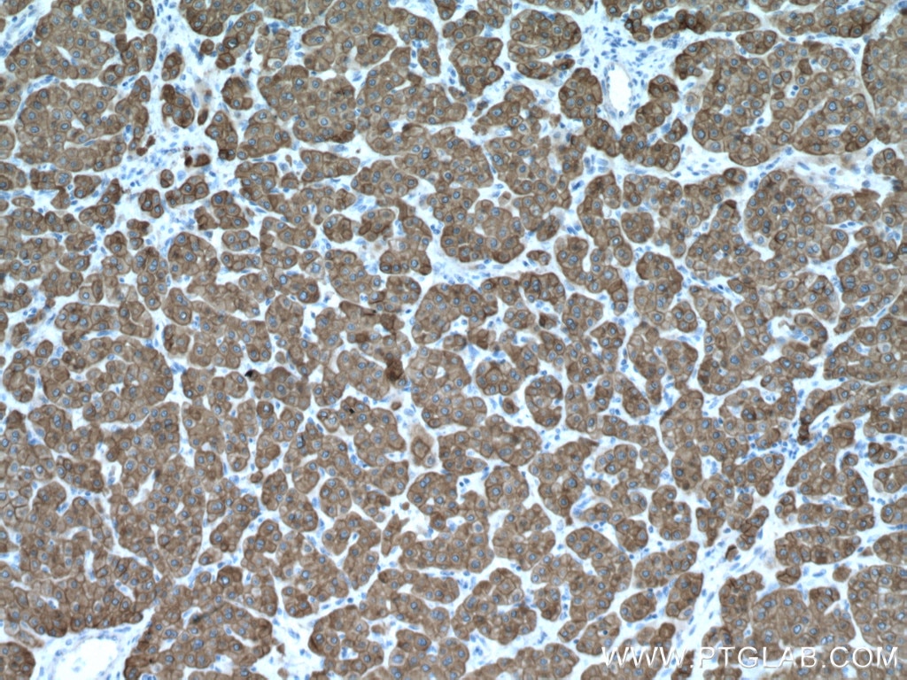 Cytokeratin 8-specific