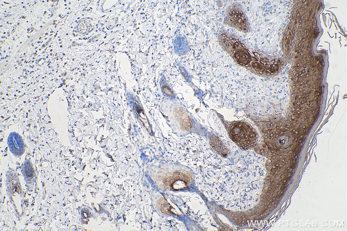 IHC staining of rat skin using 27105-1-AP