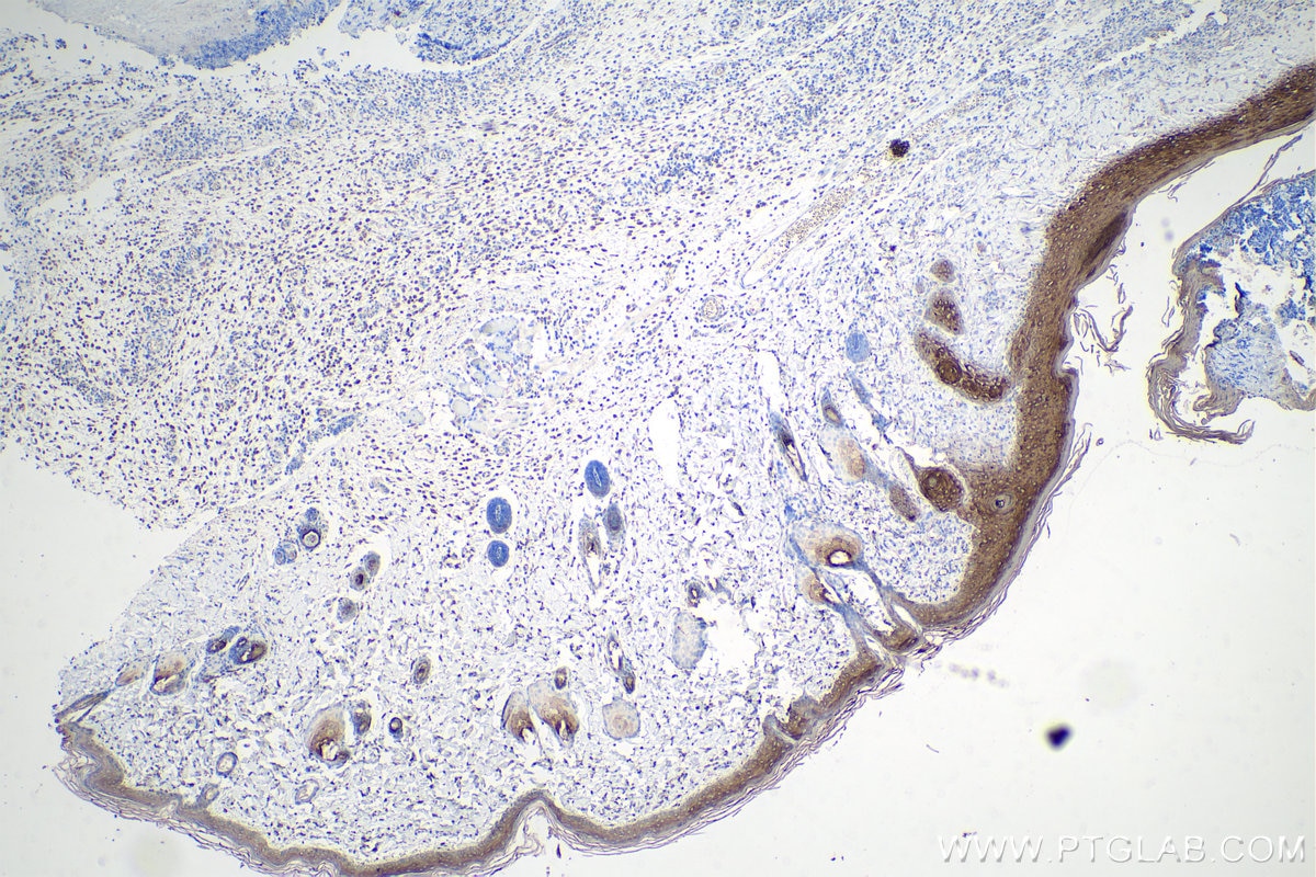 Immunohistochemistry (IHC) staining of rat skin tissue using Cytokeratin 8-specific Polyclonal antibody (27105-1-AP)