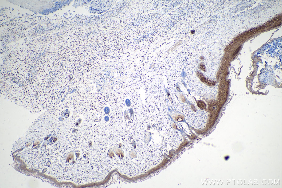 IHC staining of rat skin using 27105-1-AP