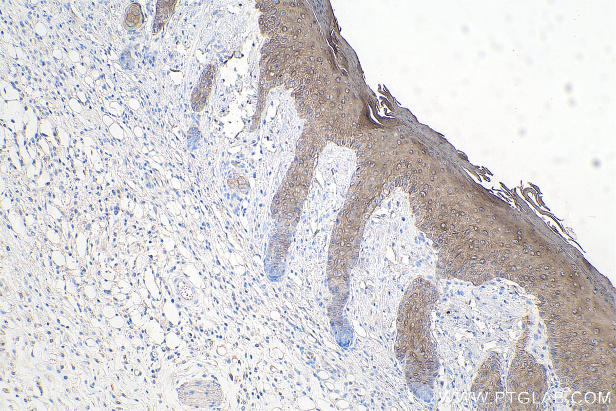 Immunohistochemistry (IHC) staining of mouse skin tissue using Cytokeratin 8-specific Polyclonal antibody (27105-1-AP)