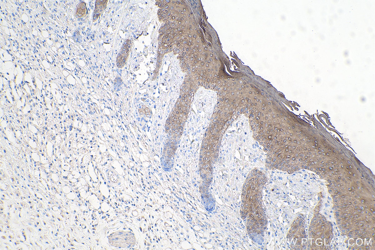 IHC staining of mouse skin using 27105-1-AP