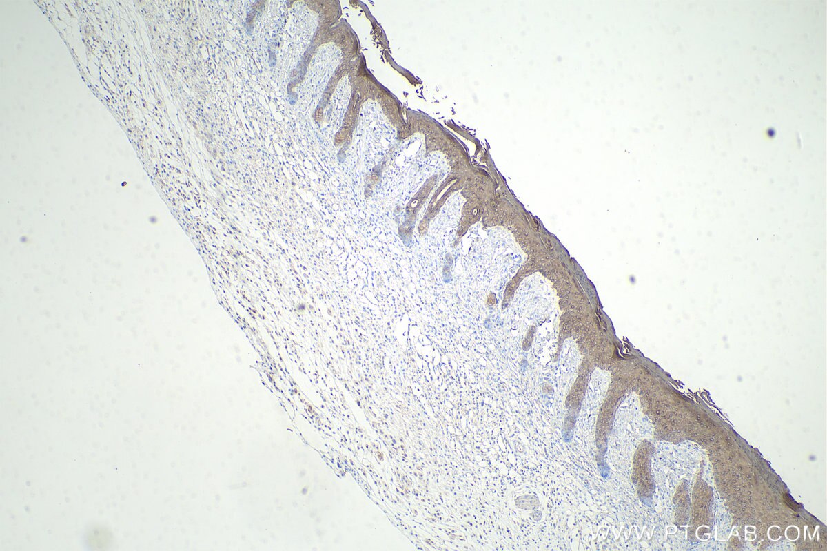 Immunohistochemistry (IHC) staining of mouse skin tissue using Cytokeratin 8-specific Polyclonal antibody (27105-1-AP)