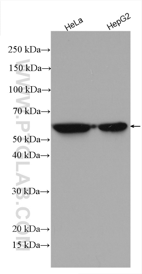 Western Blot (WB) analysis of various lysates using Cytokeratin 8-specific Polyclonal antibody (27105-1-AP)