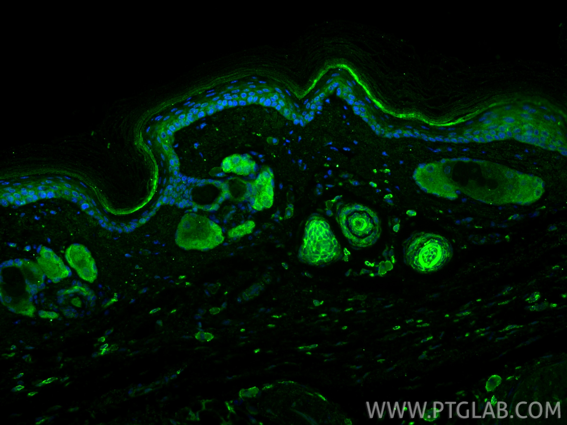 Immunofluorescence (IF) / fluorescent staining of mouse skin tissue using Cytokeratin 80 Recombinant monoclonal antibody (86313-1-RR)