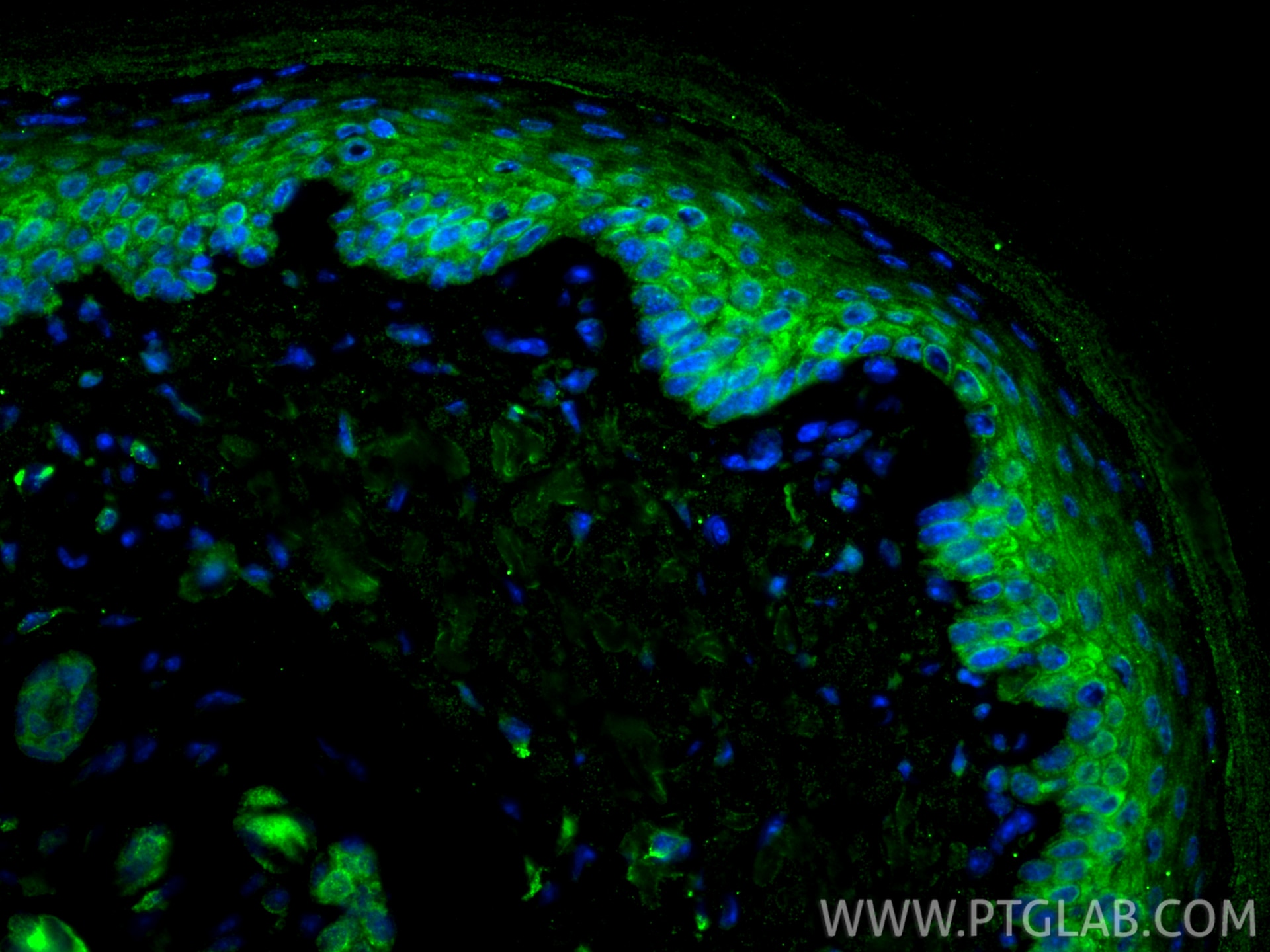 Immunofluorescence (IF) / fluorescent staining of mouse skin tissue using Cytokeratin 80 Recombinant monoclonal antibody (86313-1-RR)