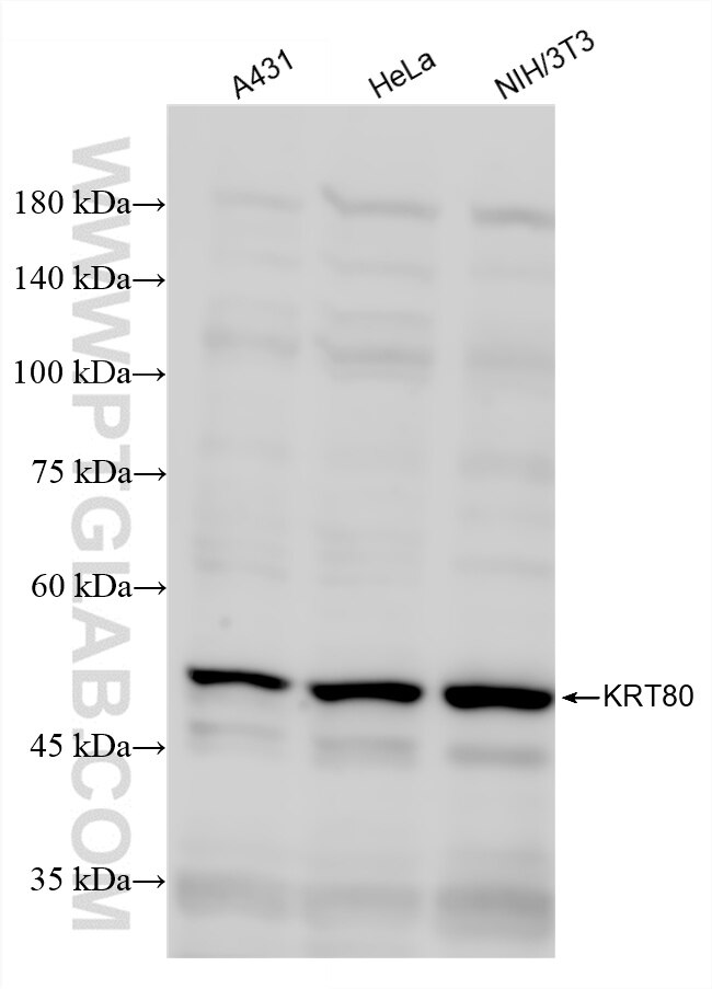 Western Blot (WB) analysis of various lysates using Cytokeratin 80 Recombinant antibody (86313-1-RR)