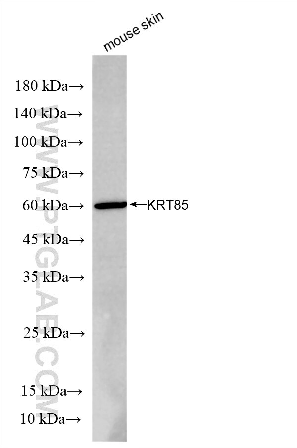 WB analysis of mouse skin using 86921-1-RR (same clone as 86921-1-PBS) Western Blot (WB) analysis of mouse skin tissue using Cytokeratin 85 Recombinant monoclonal antibody (86921-1-RR)