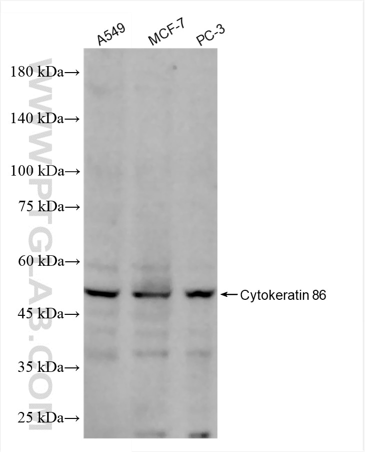 Western Blot (WB) analysis of various lysates using Cytokeratin 86 Recombinant antibody (86357-1-RR)