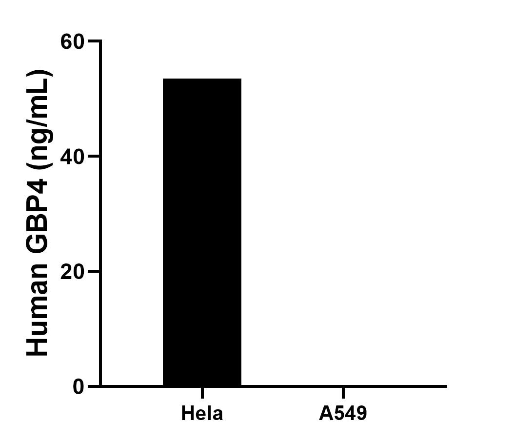 Cytometric bead array sample test of MP00655-2