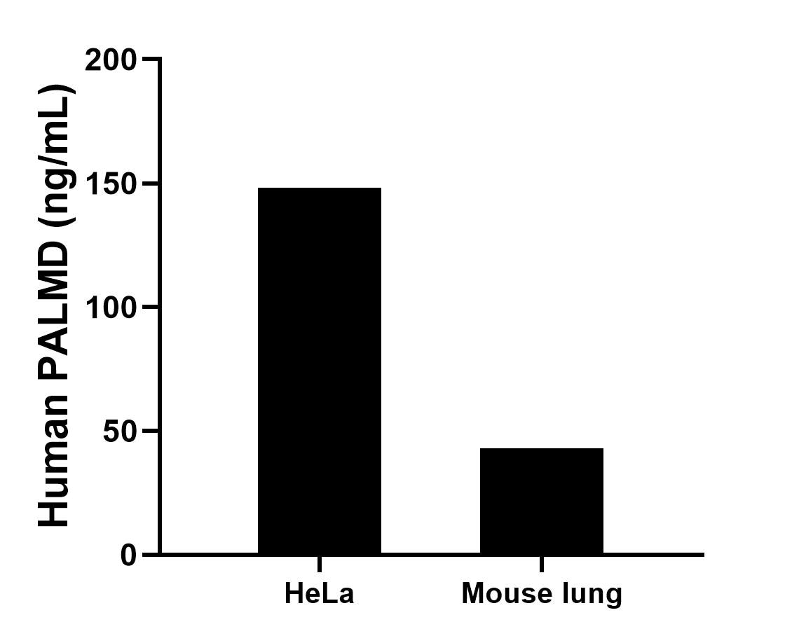 The mean PALMD concentration was determined to be 148.3 ng/mL in HeLa cell extract based on a 1.2 mg/mL extract load, 42.8 ng/mL in Mouse lung tissue extract based on a 5.0 mg/mL extract load. The mean PALMD concentration was determined to be 148.3 ng/mL in HeLa cell extract based on a 1.2 mg/mL extract load, 42.8 ng/mL in Mouse lung tissue extract based on a 5.0 mg/mL extract load.
