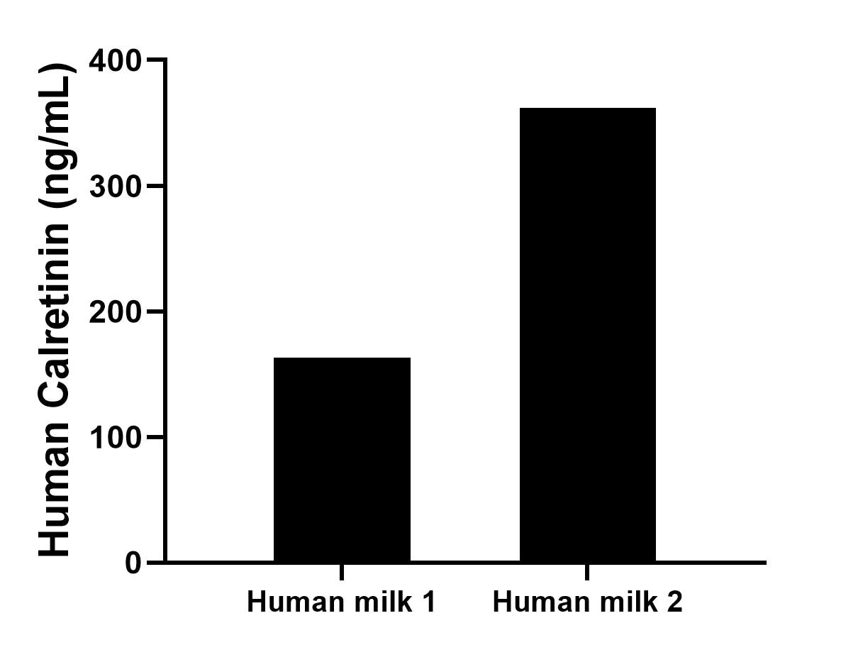 The mean Calretinin concentration was determined to be 163.4 ng/mL in human milk 1, 361.9 ng/mL in human milk 2. The mean Calretinin concentration was determined to be 163.4 ng/mL in human milk 1, 361.9 ng/mL in human milk 2.