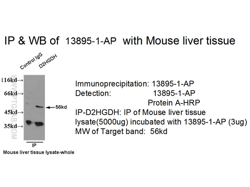 IP experiment of mouse liver tissue using 13895-1-AP