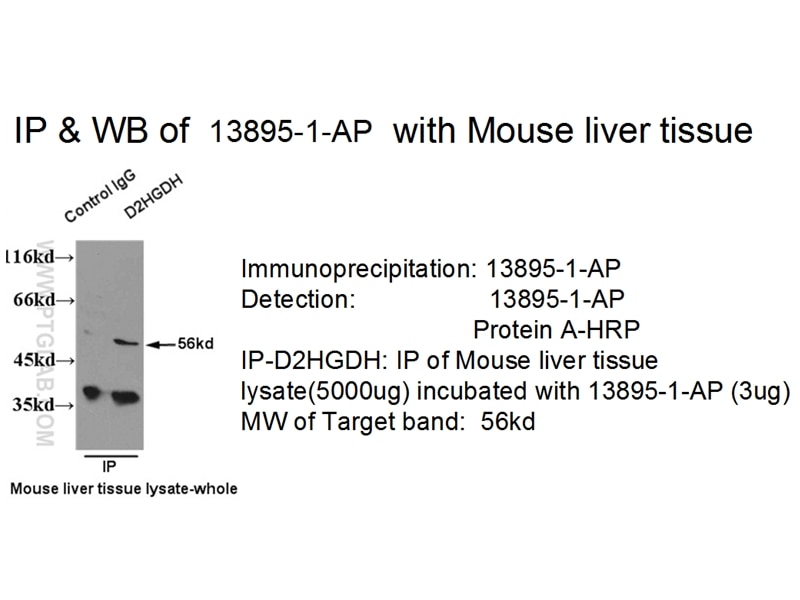 Immunoprecipitation (IP) experiment of mouse liver tissue using D2HGDH Polyclonal antibody (13895-1-AP)