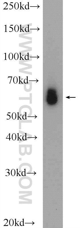 Western Blot (WB) analysis of rat liver tissue using D2HGDH Polyclonal antibody (13895-1-AP)