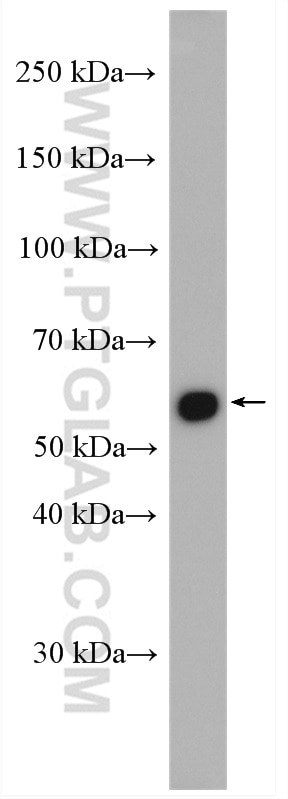 Western Blot (WB) analysis of mouse kidney tissue using D2HGDH Polyclonal antibody (13895-1-AP)