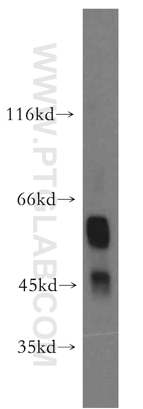 Western Blot (WB) analysis of human heart tissue using D2HGDH Polyclonal antibody (13895-1-AP)