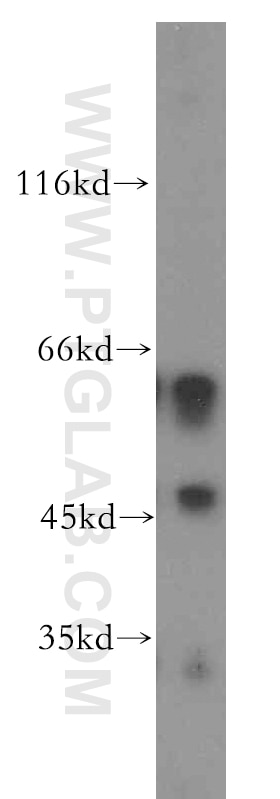 Western Blot (WB) analysis of mouse kidney tissue using D2HGDH Polyclonal antibody (13895-1-AP)