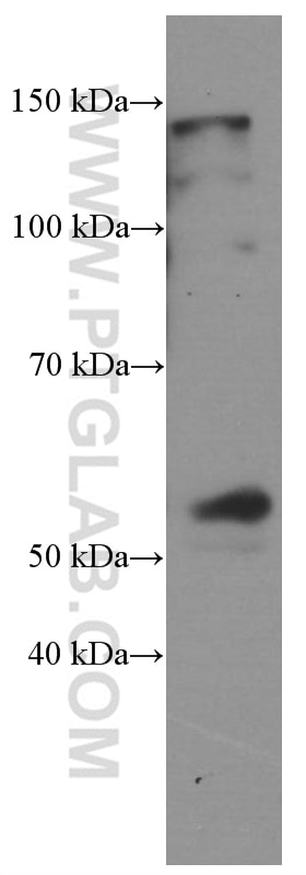 Western Blot (WB) analysis of rat heart tissue using D2HGDH Monoclonal antibody (66364-1-Ig)