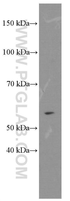 Western Blot (WB) analysis of C6 cells using D2HGDH Monoclonal antibody (66364-1-Ig)
