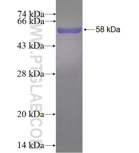 D2HGDH fusion protein Ag4857 SDS-PAGE
