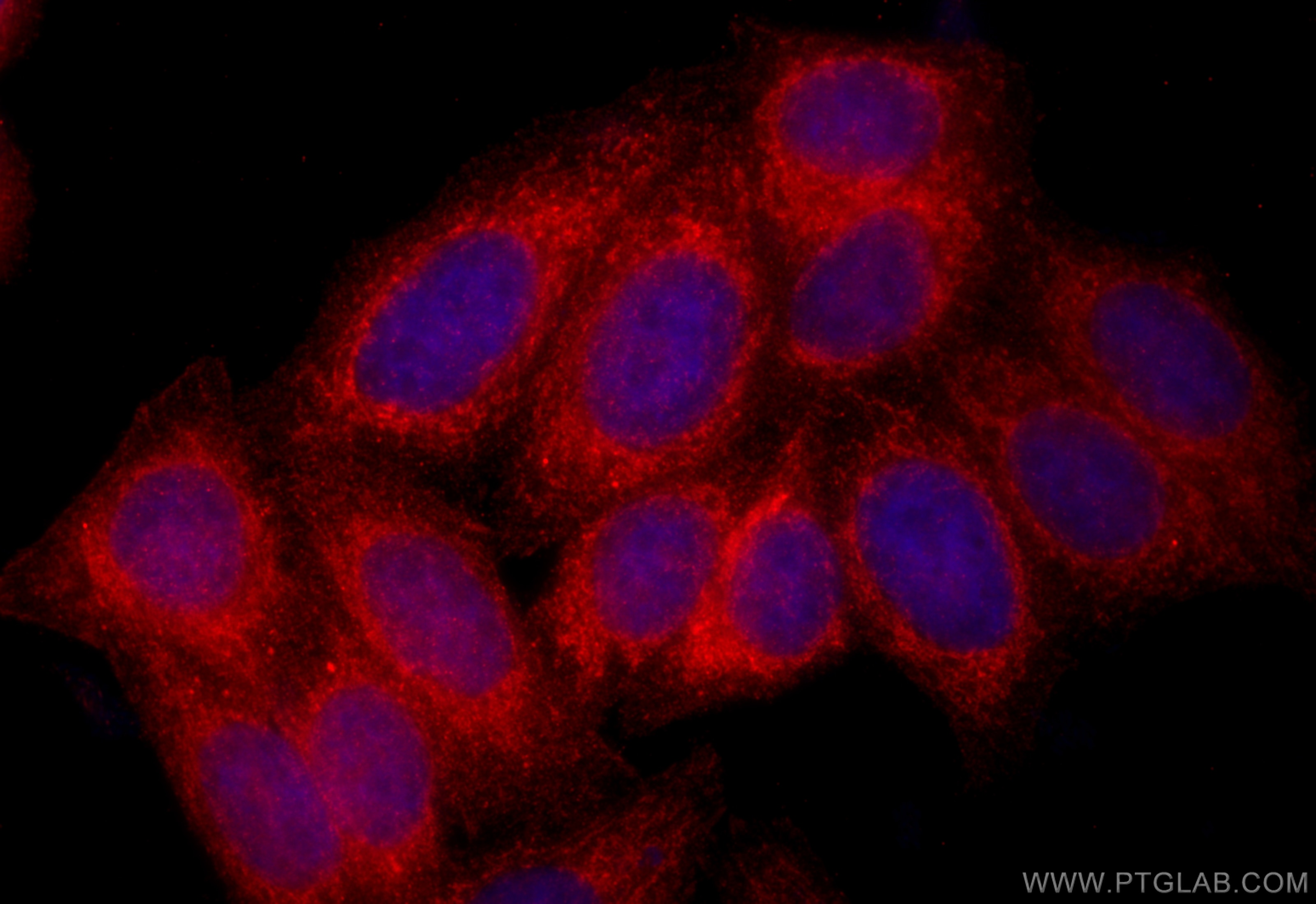 IF Staining of HepG2 using 14876-1-AP Immunofluorescence (IF) / fluorescent staining of HepG2 cells using DAAM1 Polyclonal antibody (14876-1-AP)
