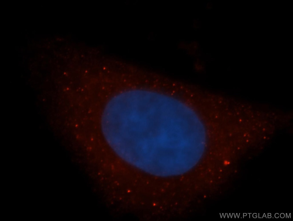 Immunofluorescence (IF) / fluorescent staining of HepG2 cells using DAAM1 Polyclonal antibody (14876-1-AP)