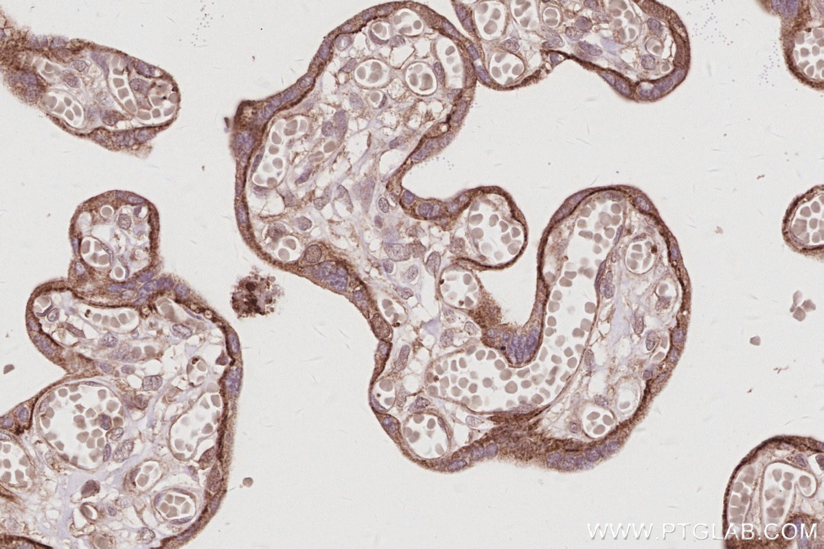 IHC staining of human placenta using 14876-1-AP Immunohistochemistry (IHC) staining of human placenta tissue using DAAM1 Polyclonal antibody (14876-1-AP)