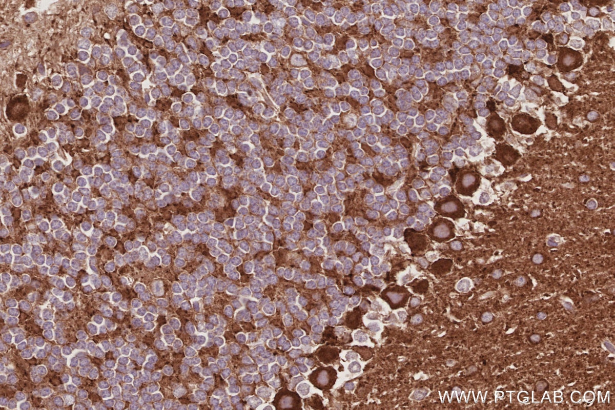 IHC staining of mouse cerebellum using 14876-1-AP Immunohistochemistry (IHC) staining of mouse cerebellum tissue using DAAM1 Polyclonal antibody (14876-1-AP)