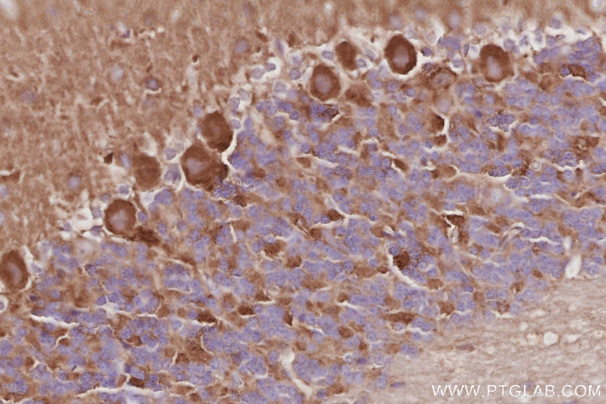 IHC staining of rat cerebellum using 14876-1-AP Immunohistochemistry (IHC) staining of rat cerebellum tissue using DAAM1 Polyclonal antibody (14876-1-AP)
