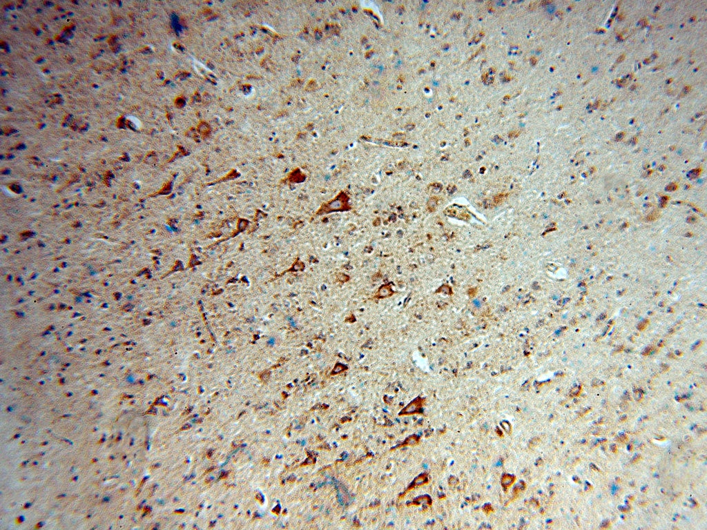 Immunohistochemistry (IHC) staining of human brain tissue using DAAM1 Polyclonal antibody (14876-1-AP)