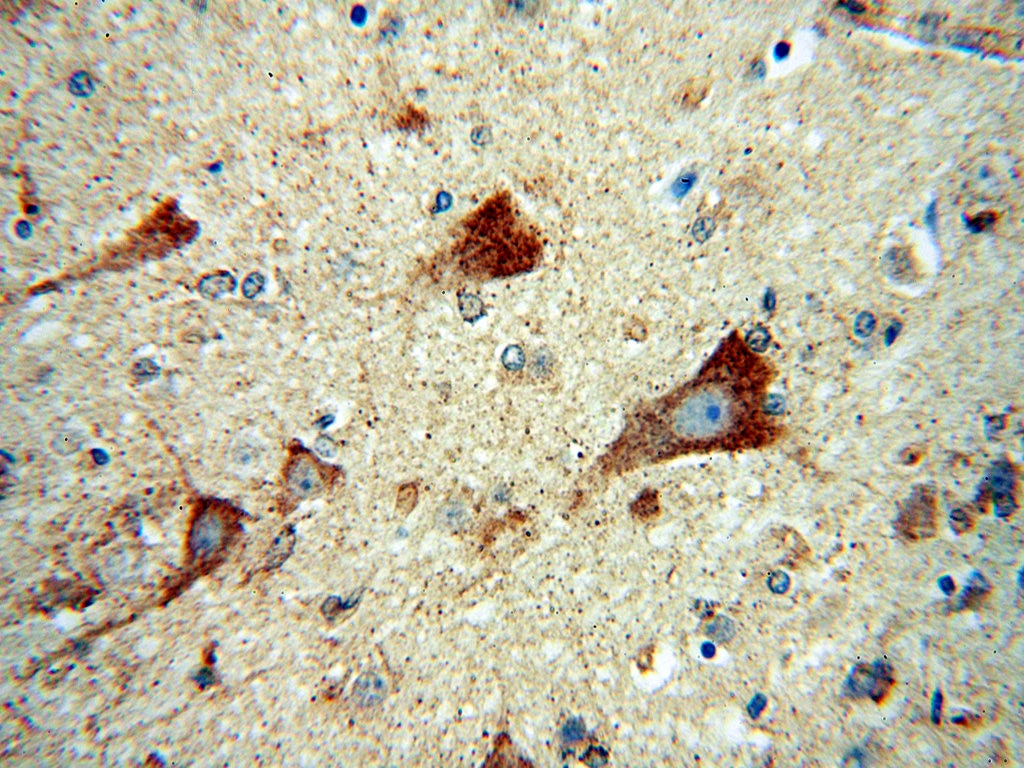 Immunohistochemistry (IHC) staining of human brain tissue using DAAM1 Polyclonal antibody (14876-1-AP)