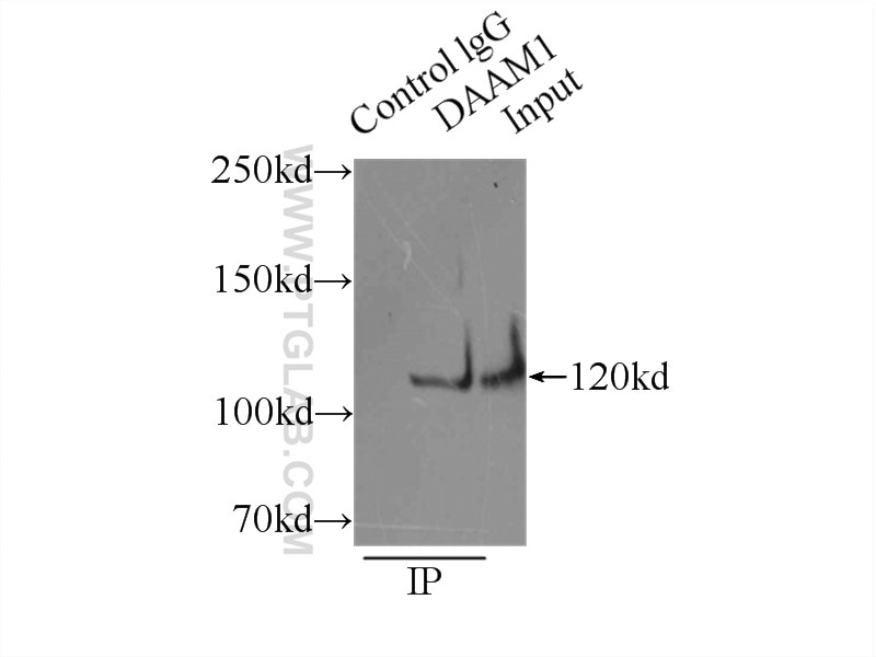 Immunoprecipitation (IP) experiment of mouse liver tissue using DAAM1 Polyclonal antibody (14876-1-AP)