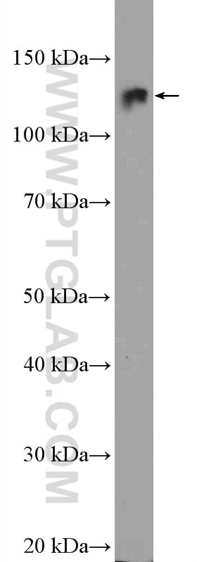 Western Blot (WB) analysis of mouse liver tissue using DAAM1 Polyclonal antibody (14876-1-AP)