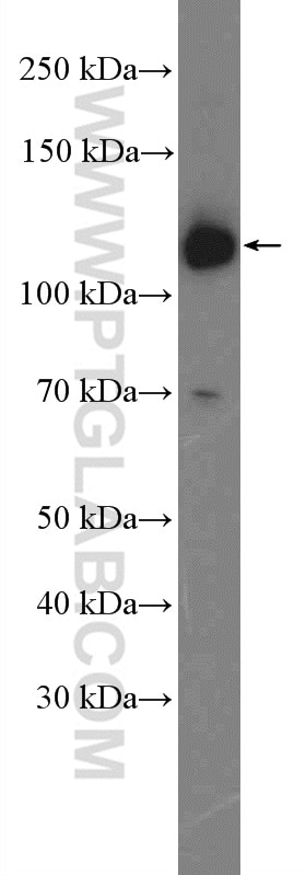 Western Blot (WB) analysis of mouse heart tissue using DAAM1 Polyclonal antibody (14876-1-AP)