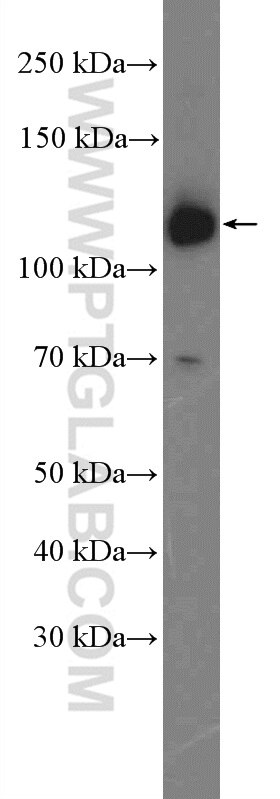 WB analysis of mouse heart using 14876-1-AP