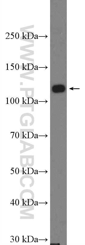 Western Blot (WB) analysis of mouse brain tissue using DAAM1 Polyclonal antibody (14876-1-AP)