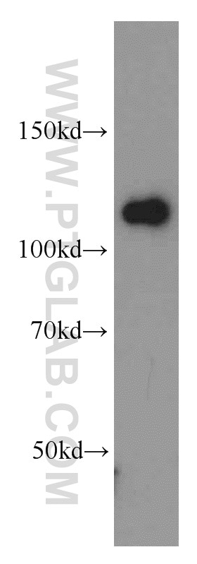 Western Blot (WB) analysis of HepG2 cells using DAAM1 Polyclonal antibody (14876-1-AP)