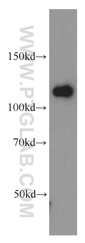 WB analysis of HepG2 using 14876-1-AP