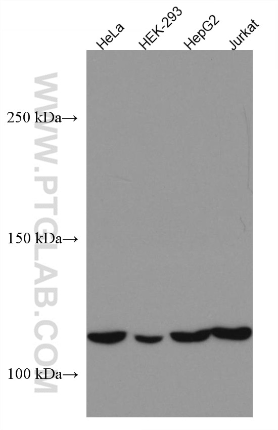 Western Blot (WB) analysis of various lysates using DAAM1 Monoclonal antibody (67287-1-Ig)