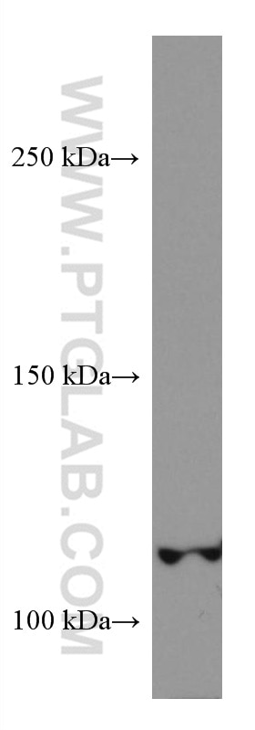 Western Blot (WB) analysis of rat heart tissue using DAAM1 Monoclonal antibody (67287-1-Ig)