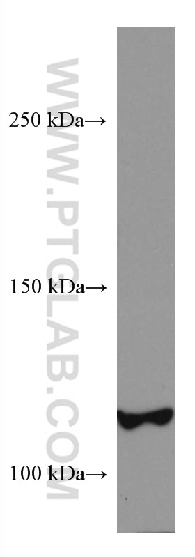 Western Blot (WB) analysis of mouse heart tissue using DAAM1 Monoclonal antibody (67287-1-Ig)