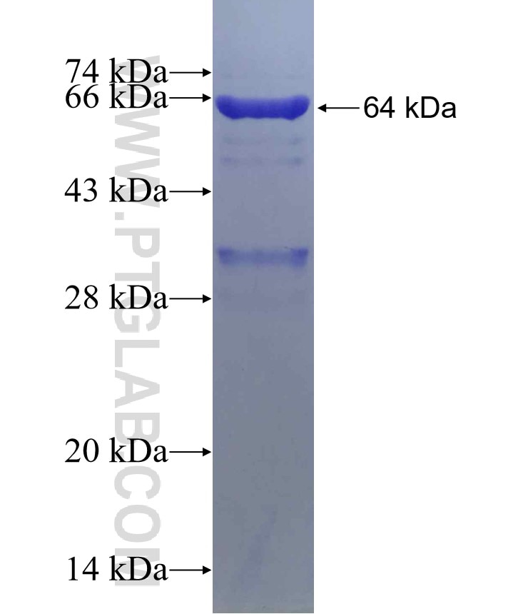 DAAM1 fusion protein Ag6648 SDS-PAGE