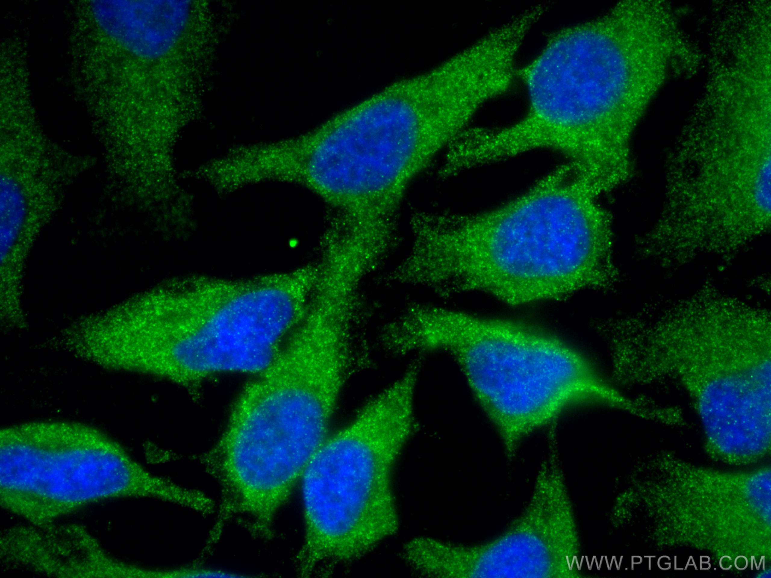Immunofluorescence (IF) / fluorescent staining of HeLa cells using DAAM2 Polyclonal antibody (25206-1-AP)