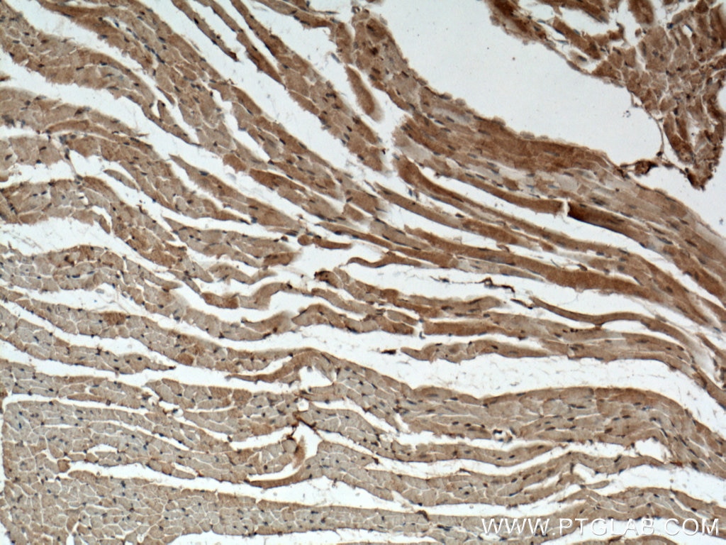 Immunohistochemistry (IHC) staining of mouse heart tissue using DAAM2 Polyclonal antibody (25206-1-AP)