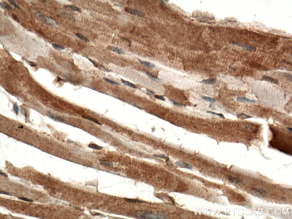 Immunohistochemistry (IHC) staining of mouse heart tissue using DAAM2 Polyclonal antibody (25206-1-AP)